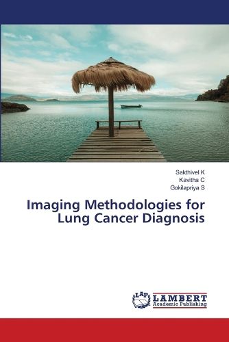 Cover image for Imaging Methodologies for Lung Cancer Diagnosis