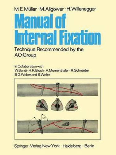 Manual of Internal Fixation: Technique Recommended by the AO-Group Swiss Association for the Study of Internal Fixation: ASIF