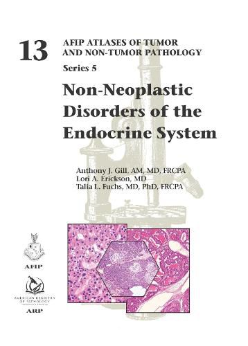 Non-Neoplastic Disorders of the Endocrine System