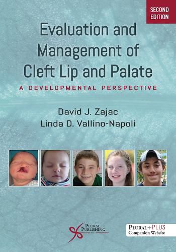 Cover image for Evaluation and Management of Cleft Lip and Palate