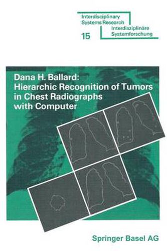 Cover image for Hierarchic Recognition of Tumors in Chest Radiographs with Computer