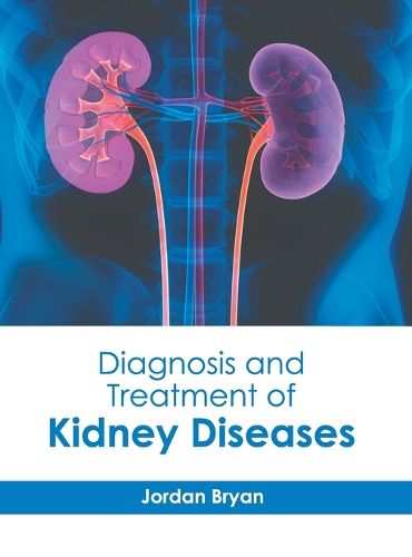 Cover image for Diagnosis and Treatment of Kidney Diseases