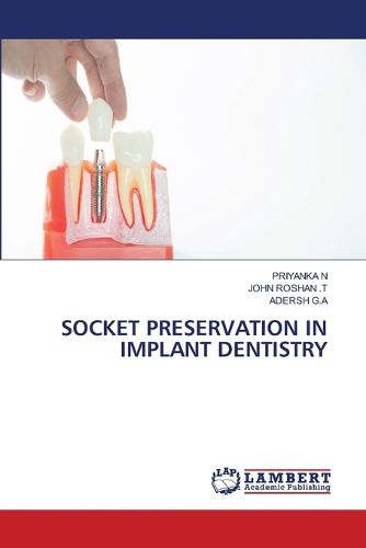 Socket Preservation in Implant Dentistry