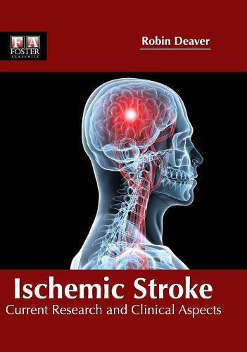 Cover image for Ischemic Stroke: Current Research and Clinical Aspects