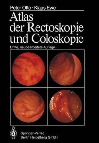 Cover image for Atlas der Rectoskopie und Coloskopie