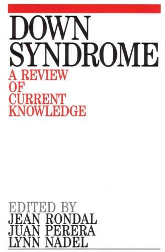 Cover image for Down's Syndrome: A Review of Current Knowledge