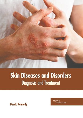 Cover image for Skin Diseases and Disorders: Diagnosis and Treatment