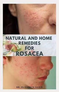 Cover image for Natural and Home Remedies for Rosacea