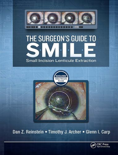 Cover image for The Surgeon's Guide to SMILE: Small Incision Lenticule Extraction