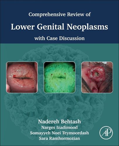 Cover image for Comprehensive review of lower genital neoplasms