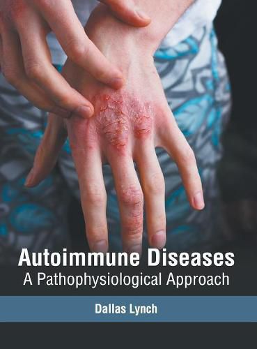 Cover image for Autoimmune Diseases: A Pathophysiological Approach