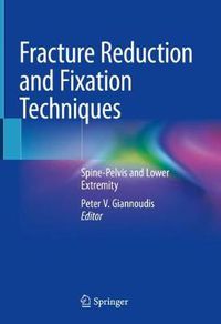 Cover image for Fracture Reduction and Fixation Techniques: Spine-Pelvis and Lower Extremity