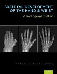 Cover image for Skeletal Development of the Hand and Wrist: A Radiographic Atlas and Digital Bone Age Companion