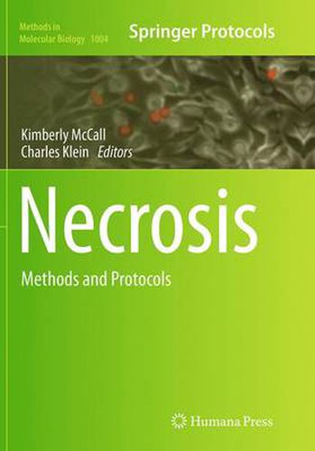 Necrosis: Methods and Protocols