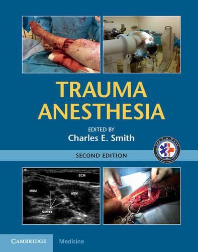 Cover image for Trauma Anesthesia