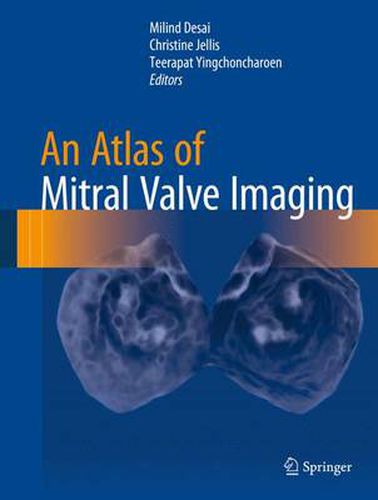 Cover image for An Atlas of Mitral Valve Imaging