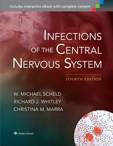 Cover image for Infections of the Central Nervous System