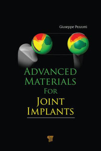 Cover image for Advanced Materials for Joint Implants