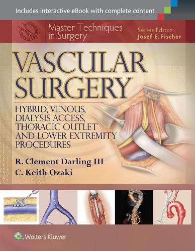 Cover image for Master Techniques in Surgery: Vascular Surgery: Hybrid, Venous, Dialysis Access, Thoracic Outlet, and Lower Extremity Procedures