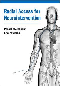 Cover image for Radial Access for Neurointervention