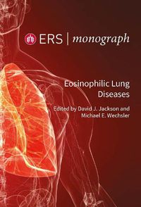 Cover image for Eosinophilic Lung Diseases