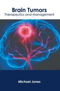 Cover image for Brain Tumors: Therapeutics and Management