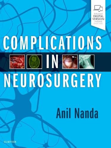 Cover image for Complications in Neurosurgery