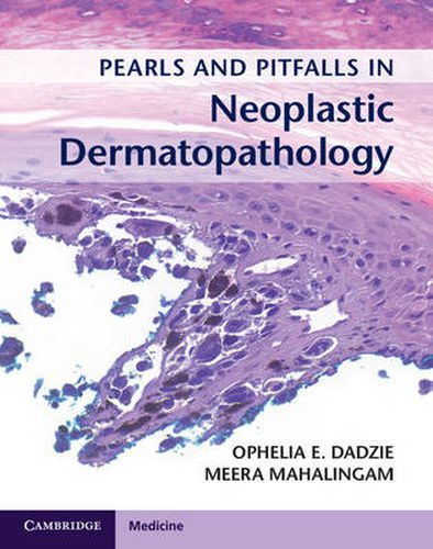 Cover image for Pearls and Pitfalls in Neoplastic Dermatopathology with Online Access