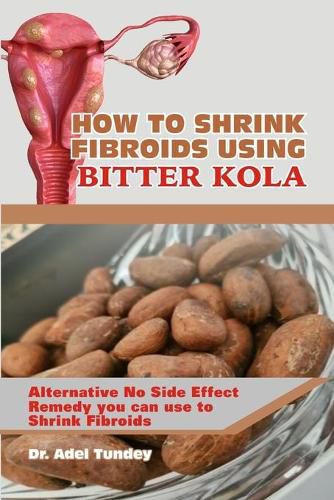 How to Shrink Fibroids Using Bitter Kola