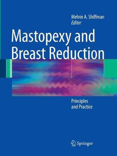 Cover image for Mastopexy and Breast Reduction: Principles and Practice