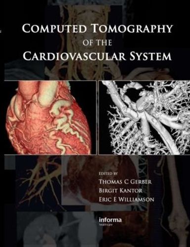 Cover image for Computed Tomography of the Cardiovascular System