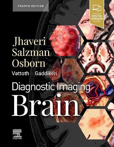 Cover image for Diagnostic Imaging: Brain