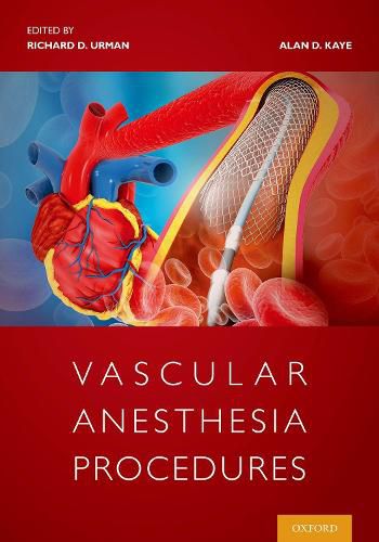 Cover image for Vascular Anesthesia Procedures