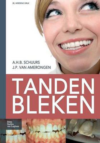 Cover image for Tanden Bleken