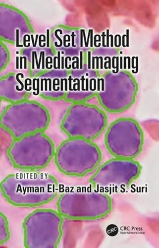 Cover image for Level Set Method in Medical Imaging Segmentation