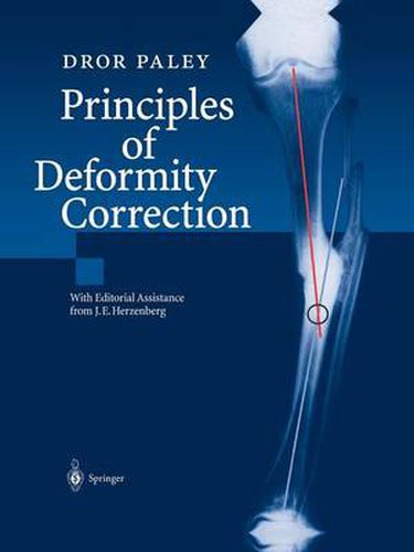 Cover image for Principles of Deformity Correction