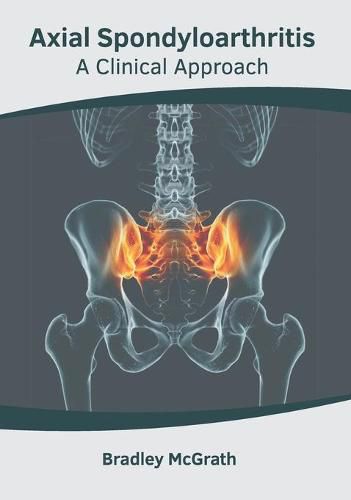 Cover image for Axial Spondyloarthritis: A Clinical Approach