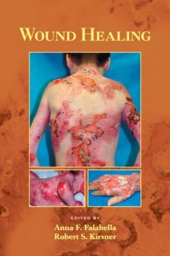 Cover image for Wound Healing