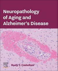 Cover image for Neuropathology of Aging and Alzheimer's Disease