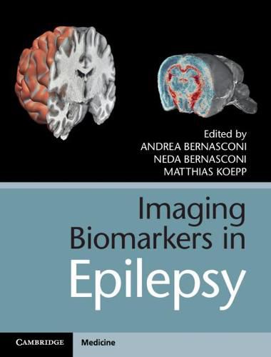 Cover image for Imaging Biomarkers in Epilepsy