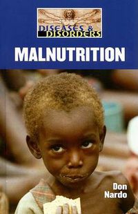 Cover image for Malnutrition