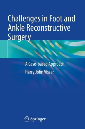 Cover image for Challenges in Foot and Ankle Reconstructive Surgery