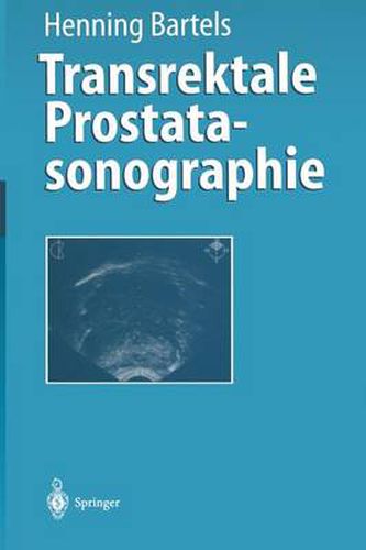 Cover image for Transrektale Prostatasonographie