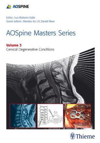 Cover image for AOSpine Masters Series Volume 3: Cervical Degenerative Conditions