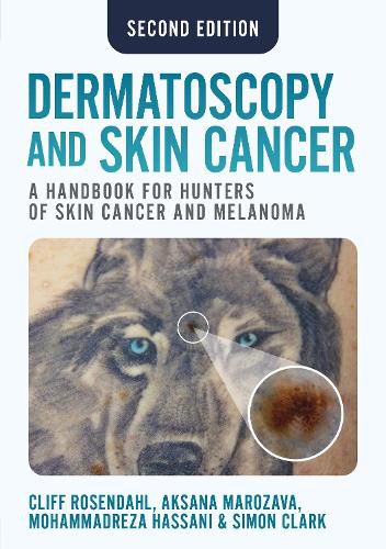 Cover image for Dermatoscopy and Skin Cancer, second edition