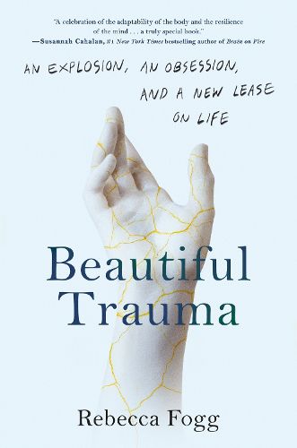 Cover image for Beautiful Trauma: An Explosion, an Obsession, and a New Lease on Life