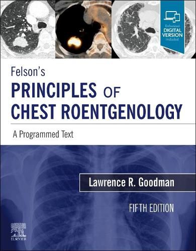 Cover image for Felson's Principles of Chest Roentgenology, A Programmed Text: A Programmed Text