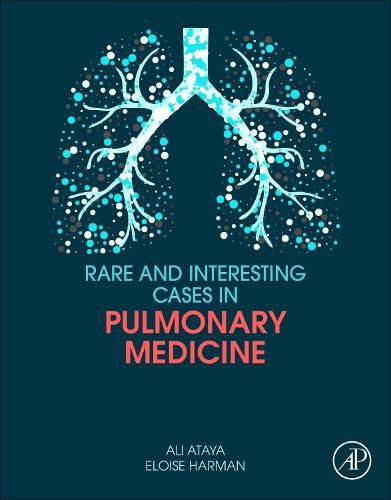 Cover image for Rare and Interesting Cases in Pulmonary Medicine