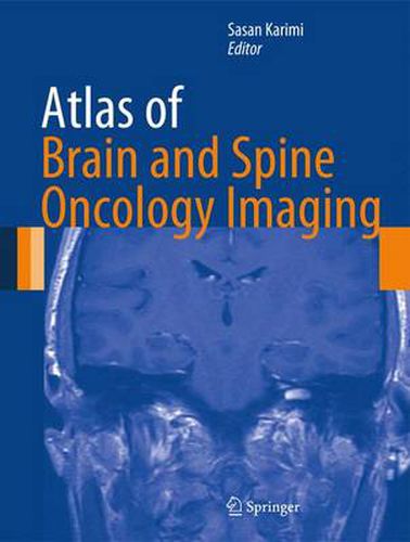 Cover image for Atlas of Brain and Spine Oncology Imaging