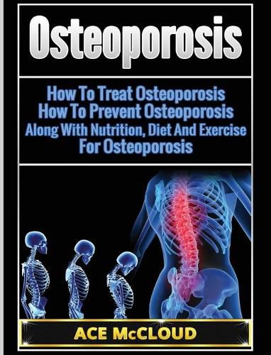 Cover image for Osteoporosis: How To Treat Osteoporosis: How To Prevent Osteoporosis: Along With Nutrition, Diet And Exercise For Osteoporosis